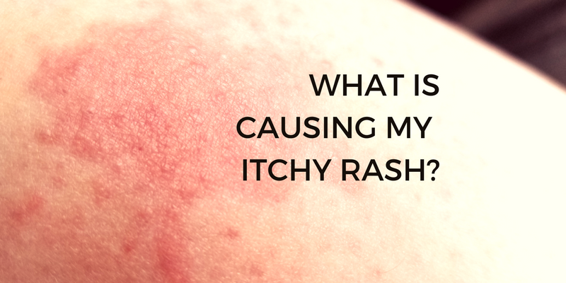 reason for whole body itching no rash