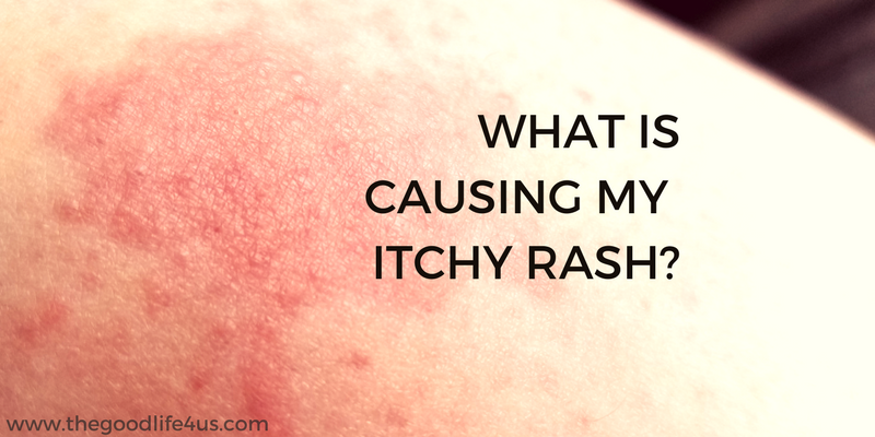 skin rashes that itch and hot